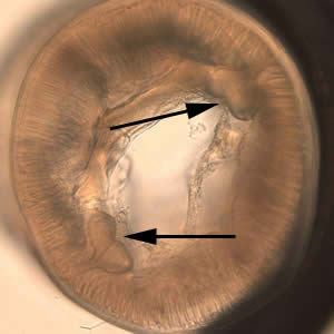 Cross-section of Pseudoterranova sp. Note the large butterfly-shaped lateral chords (black arrows), characteristic for this genus. Adapted from CDC