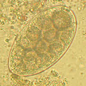 Egg of a trichostrongyle from the same specimen as Figures 1 and 2. In this egg, a developing larva can be observed. Adapted from CDC