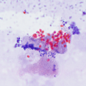 Spores of E. cuniculi from urine stained with Ryan's modified trichrome. Adapted from CDC