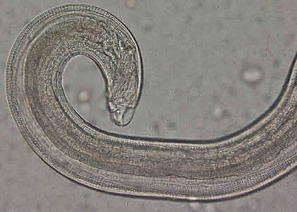 Close-up of the posterior end of the worm in Figure 1. Note the blunt end. The spicule is withdrawn into the worm in this specimen. Adapted from CDC