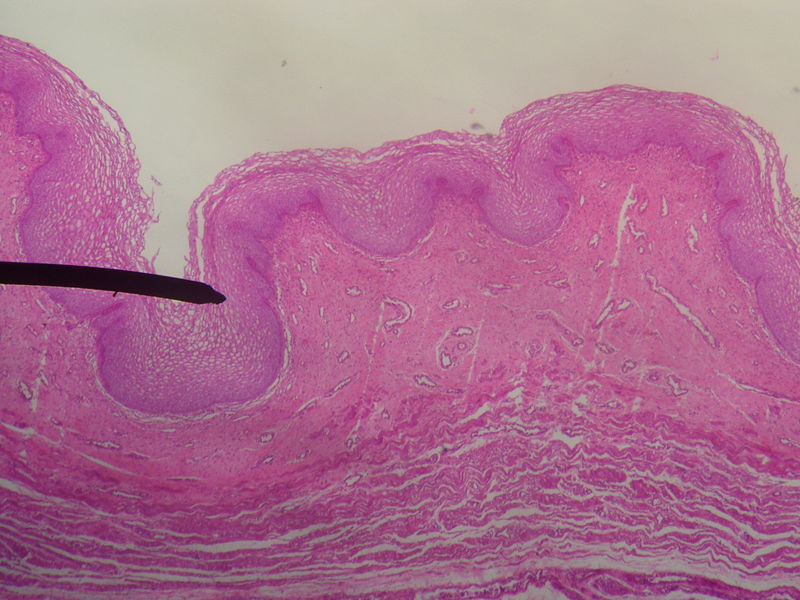 Layers of the vaginal wall.