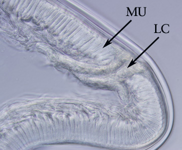 Higher magnification of the specimen in Figure 1. Note the tall, prominent muscle cells (MU) and Y-shaped lateral chords (LC), characteristic for this genus. Adapted from CDC