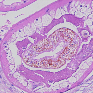 Higher-magnification of the specimens shown in Figures 1 and 2, showing a close-up of the characteristic intestine, with cuboidal, uninucleate cells, pigment, and microvilli. Adapted from CDC