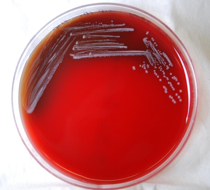 Brucella abortus bacteria grown on a medium of sheep’s blood agar (SBA) 72hrs. From Public Health Image Library (PHIL). [16]