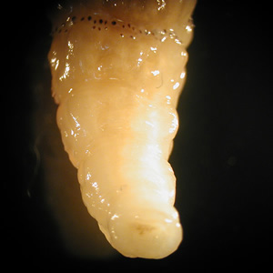 Close-up of the posterior end of one of the larvae from Figure 1. Adapted from CDC