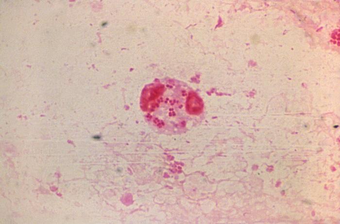 Photomicrograph reveals Gram-negative rods, and Gram-negative cocci, which were determined to be Haemophilus influenzae, and non-meningococcal Neisseria sp. organisms respectively (1000X mag). From Public Health Image Library (PHIL). [4]