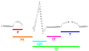 The EKG complex. P=P wave, PR=PR interval, QRS=QRS complex, QT=QT interval, ST=ST segment, T=T wave