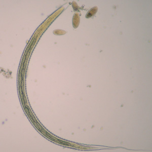 L3 larva of Oesophagostomum sp., obtained via coproculture from the feces of a baboon (Papio ursinus) in South Africa. Note the long, thin, pointed tail. Image courtesy of the UTC Baboon Research Unit, University of Cape Town, South Africa. Adapted from CDC