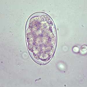 Egg of Oesophagostomum sp. in an unstained wet mount of stool. Adapted from CDC