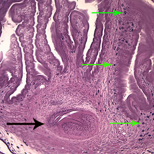 The extensive folding of the spiral canal and one sucker of the scolex (black arrow) are apparent. Calcareous corpuscles can be seen in the fibrous tissues (green arrows). Adapted from CDC