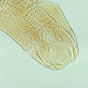 Adult worm of Ancylostoma duodenal. Anterior end is depicted showing cutting teeth. Adapted from CDC