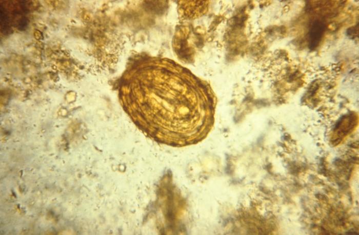 This photomicrograph depicts a fertilized egg of the parasite Ascaris lumbricoides. From Public Health Image Library (PHIL). [6]
