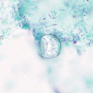 Oocyst of C. cayetanensis stained with trichrome; while the oocyst is visible, the staining characteristics are inadequate for a reliable diagnosis. Adapted from CDC