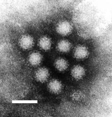 Norovirus. This RNA virus causes winter vomiting disease. It is often in the news as a cause of gastro-enteritis on cruise ships and in hospitals.