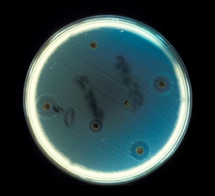 Enterococcus faecalis cultured on an agar plate, testing for drug sensitivity in an anaerobic environment. From Public Health Image Library (PHIL). [4]