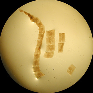 Proglottids of Mesocestoides sp., collected from the stool of a dog. Adapted from CDC