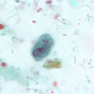 G. duodenalis cyst stained with trichrome. Adapted from CDC