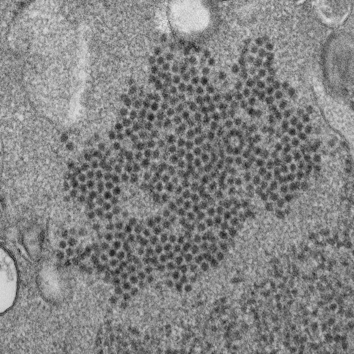 Transmission electron micrograph (TEM) reveals numerous, spheroid-shaped Enterovirus-D68 (EV-D68) virions. From Public Health Image Library (PHIL). [27]