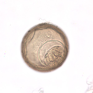 Higher magnification (400x) of one of the eggs in Figure 3. Adapted from CDC
