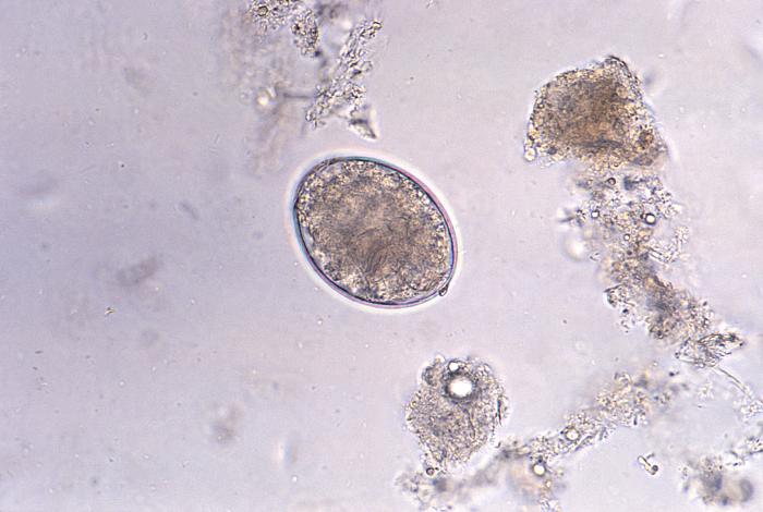 Photomicrograph reveals the presence of a cestode, Diphyllobothrium latum, or “broad” tapeworm, egg, which is described as oval or ellipsoidal, and range in size from 55µm to 75µm by 40µm to 50µm (400X mag). Source: https://phil.cdc.gov/phil/home.asp