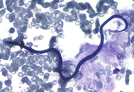 Microfilaria of L. loa in a thin blood smear, stained with Giemsa. Adapted from CDC