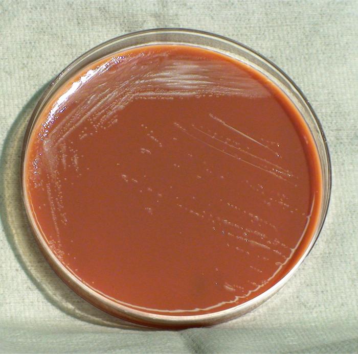 Gram-negative Burkholderia thailandensis bacteria, which was grown on a medium of chocolate agar 24hrs. From Public Health Image Library (PHIL). [5]