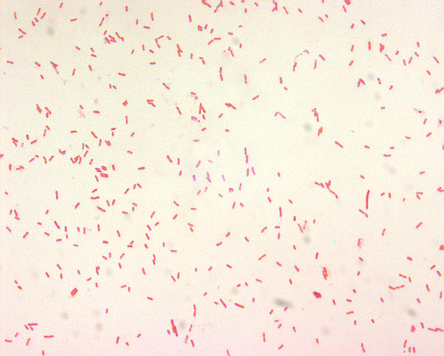 Yersinia pestis, Gram-negative bacillus Adapted from Public Health Image Library (PHIL), Centers for Disease Control and Prevention.[18]