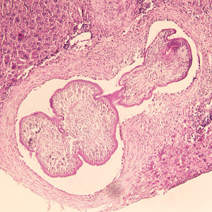 Tetrathyridium of Mesocestoides sp. in the liver of a laboratory-infected mouse. Adapted from CDC