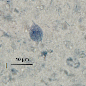 Trophozoite of P. hominis in a stool specimen, stained with iron hematoxylin. Adapted from CDC
