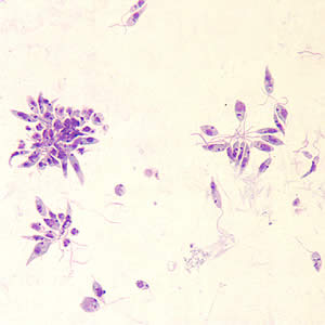 Leishmania sp. promastigotes from culture. Adapted from CDC