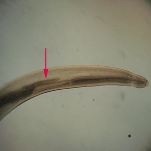 Anterior end of Pseudoterranova sp. The red arrow indicates the intestinal cecum. Adapted from CDC