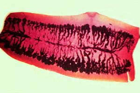 Mature proglottid of T. saginata, stained with carmine. Note the number of primary uterine branches (>12). Adapted from CDC