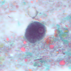 Trophozoite of E. polecki stained with trichrome. Adapted from CDC