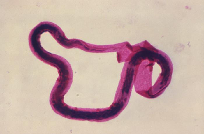 Photomicrograph reveals some of the ultrastructural details displayed at the posterior end of the microfilarial-staged nematode, Brugia malayi, one of the organisms responsible for the disease known as lymphatic filariasis. From Public Health Image Library (PHIL). [3]