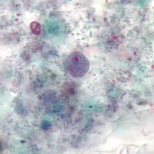 Trophozoite of E. nana stained with trichrome. Adapted from CDC