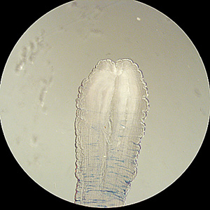 Close-up of the anterior end of the sparganum in Figures 1 and 2. Note the end is thickened and wrinkled, and possesses a characteristic cleft-like invagination. Adapted from CDC
