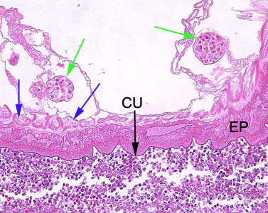 Higher-magnification (200x) of the specimen in Figure 1. Identifiable in this image are the characteristic thin cuticle (CU, black arrow), syncytial epidermis (EP), longitudinal muscles (blue arrows) and eggs (green arrows). Adapted from CDC
