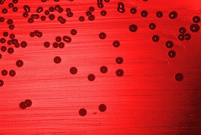 Blood agar plate culture of Haemophilus influenzae. From Public Health Image Library (PHIL). [8]