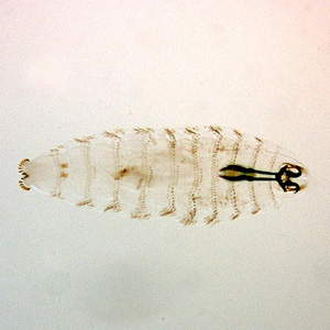 First instar larva of O. ovis, collected from the eye of a patient in India presenting with conjunctivitis. Image courtesy of the L V Prasad Eye Institute, Banjara Hills, India. Adapted from CDC