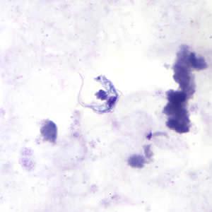 Trypansoma brucei ssp. in a thick blood smear stained with Giemsa. Adapted from CDC