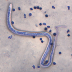 Close-up of the posterior end of the worm in Figure 3. Adapted from CDC