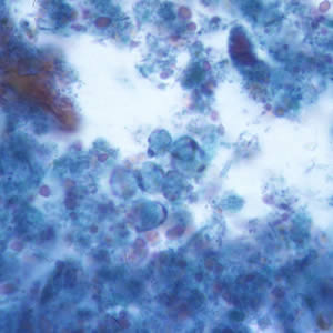 B. hominis cyst-like forms stained with trichrome. Adapted from CDC