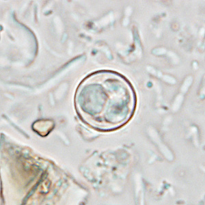 File:Cyclospora wetmount HB1.jpg