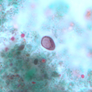 Cyst of I. buetschlii stained with trichrome. In this specimen, both the nucleus and large glycogen vacuole are visible. Adapted from CDC