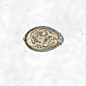 C. sinensis egg. Note the operculum resting on "shoulders;" image taken at 400× magnification. Adapted from CDC