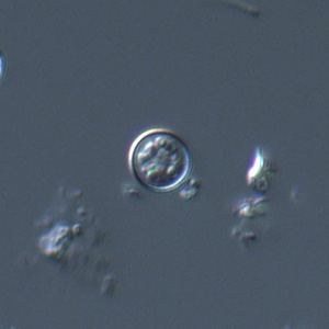 Oocyst of C. cayetanensis viewed under DIC microscopy. Adapted from CDC