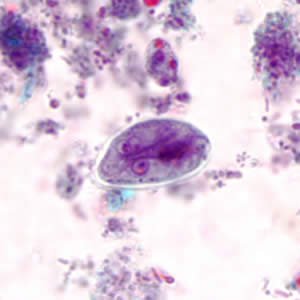 File:Giardia cyst tric2.jpg