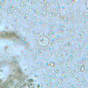 Cyst of I. buetschlii in an unstained concentrated wet mount. In these cysts, the glycogen vacuole can be seen as a large, oval refractile body. Adapted from CDC
