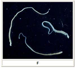 Three adult Hymenolepis nana tapeworms