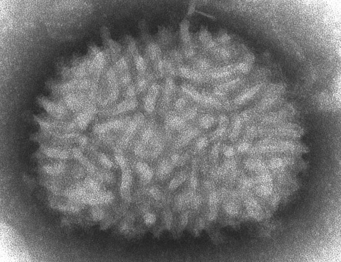 A TEM micrograph of Vaccinia virus virions.